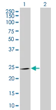 Western blot - SNAP25 overexpression 293T lysate (whole cell) (AB94226)