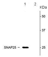 Western blot - Anti-SNAP25 (phospho S187) antibody (AB169871), expandable thumbnail