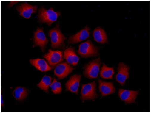 Immunocytochemistry/ Immunofluorescence - Anti-SNAP29 antibody [EPR9198(2)] (AB181151)
