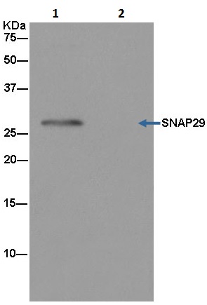 Immunoprecipitation - Anti-SNAP29 antibody [EPR9198(2)] - BSA and Azide free (AB240248), expandable thumbnail