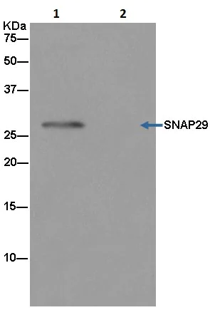 Immunoprecipitation - Anti-SNAP29 antibody [EPR9198(2)] - BSA and Azide free (AB240248)