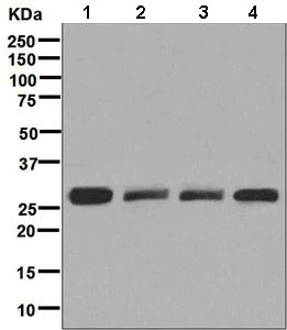 Western blot - Anti-SNAP29 antibody [EPR9199] (AB138500)