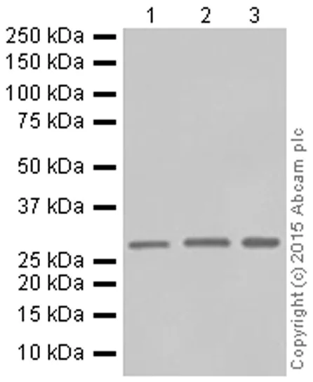 Western blot - Anti-SNAP29 antibody [EPR9199] (AB138500)