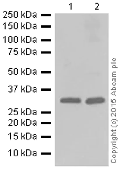 Western blot - Anti-SNAP29 antibody [EPR9199] (AB138500)