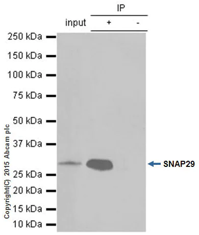Immunoprecipitation - Anti-SNAP29 antibody [EPR9199] - BSA and Azide free (AB240110)