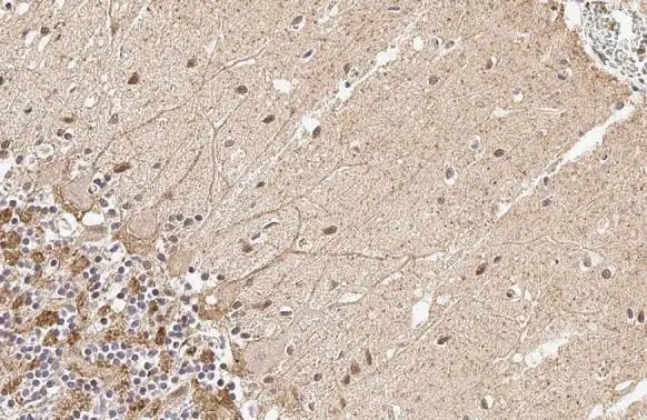 Immunohistochemistry (Formalin/PFA-fixed paraffin-embedded sections) - Anti-SNAP91 antibody [HL1657] (AB308182), expandable thumbnail