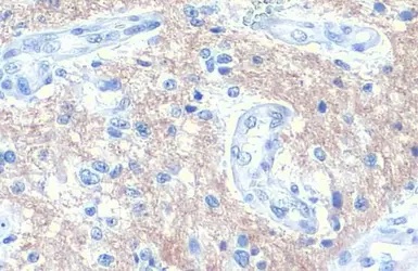 Immunohistochemistry paraffin embedded sections - Anti-SNAP91 antibody [HL1657] (AB308182), expandable thumbnail