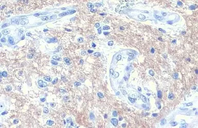 Immunohistochemistry paraffin embedded sections - Anti-SNAP91 antibody [HL1657] (AB308182)