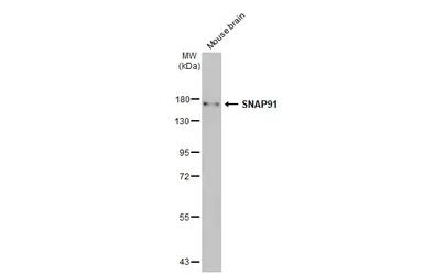 Western blot - Anti-SNAP91 antibody [HL1657] (AB308182)