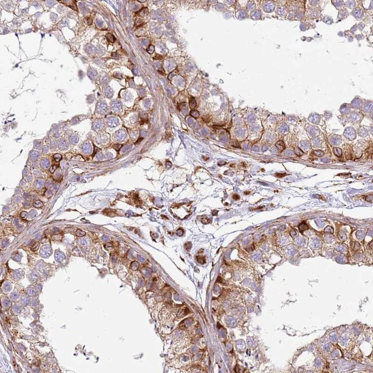Immunohistochemistry (Formalin/PFA-fixed paraffin-embedded sections) - Anti-SNAPIN antibody (AB254583)