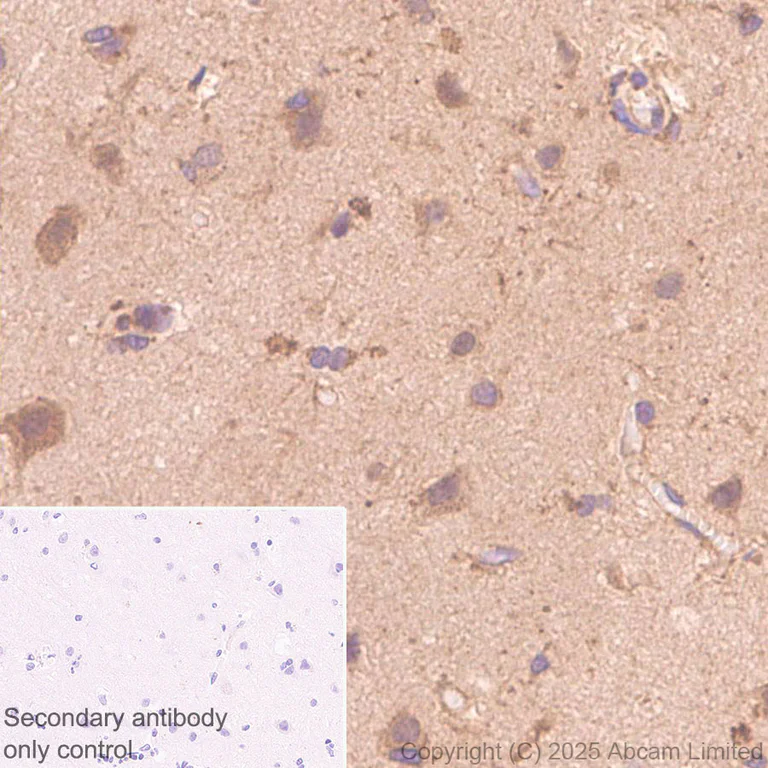 Immunohistochemistry (Formalin/PFA-fixed paraffin-embedded sections) - Anti-Snapin antibody [RM2091] (AB324947)