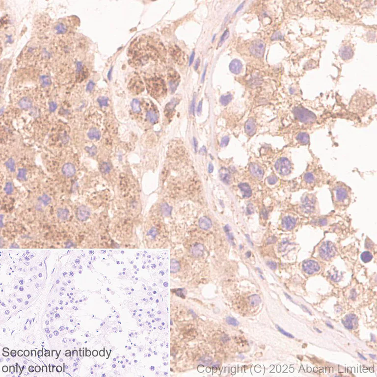 Immunohistochemistry (Formalin/PFA-fixed paraffin-embedded sections) - Anti-Snapin antibody [RM2091] (AB324947)