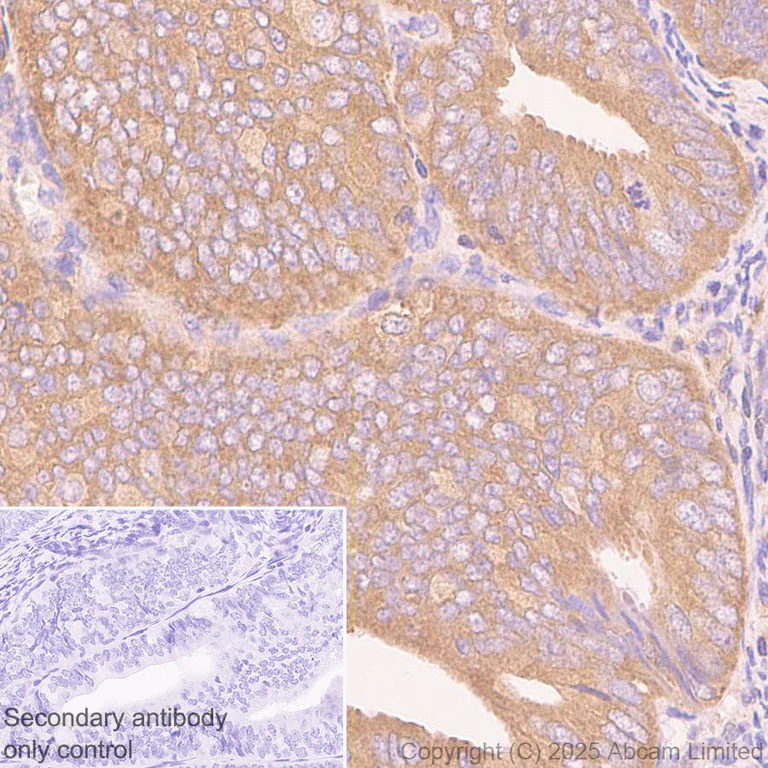 Immunohistochemistry (Formalin/PFA-fixed paraffin-embedded sections) - Anti-Snapin antibody [RM2091] (AB324947)