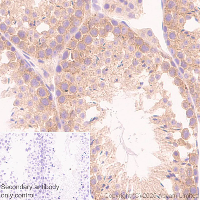 Immunohistochemistry (Formalin/PFA-fixed paraffin-embedded sections) - Anti-Snapin antibody [RM2091] (AB324947)