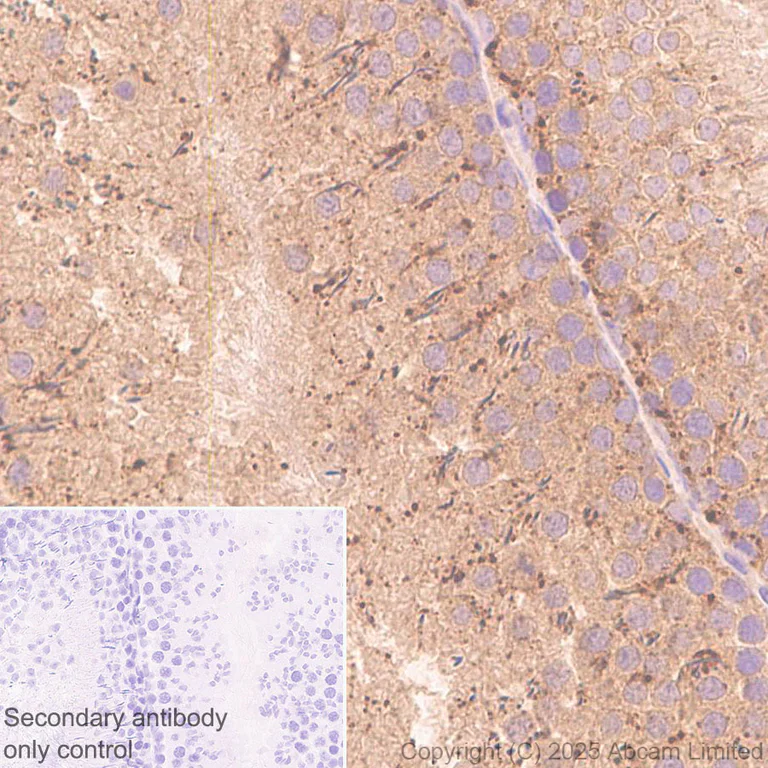 Immunohistochemistry (Formalin/PFA-fixed paraffin-embedded sections) - Anti-Snapin antibody [RM2091] (AB324947)
