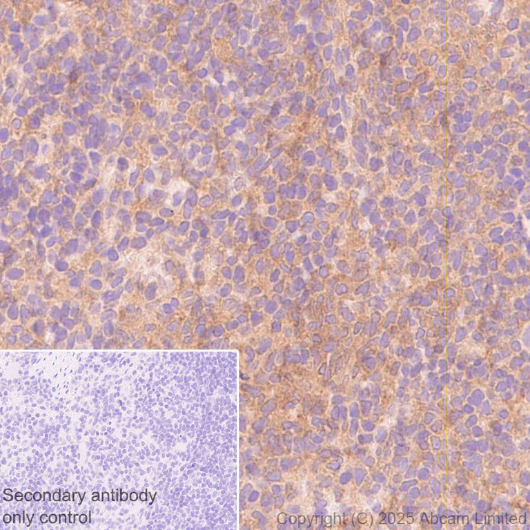 Immunohistochemistry (Formalin/PFA-fixed paraffin-embedded sections) - Anti-Snapin antibody [RM2091] (AB324947)