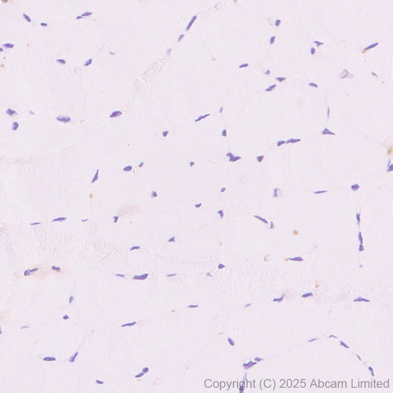 Immunohistochemistry (Formalin/PFA-fixed paraffin-embedded sections) - Anti-Snapin antibody [RM2091] (AB324947)