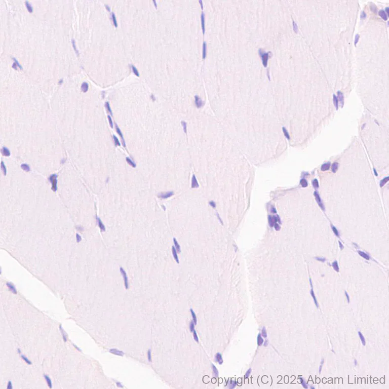 Immunohistochemistry (Formalin/PFA-fixed paraffin-embedded sections) - Anti-Snapin antibody [RM2091] (AB324947)