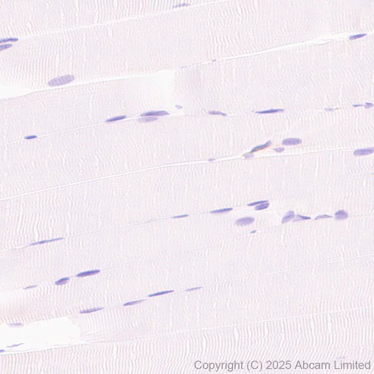 Immunohistochemistry (Formalin/PFA-fixed paraffin-embedded sections) - Anti-Snapin antibody [RM2091] (AB324947)