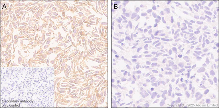Immunohistochemistry (Formalin/PFA-fixed paraffin-embedded sections) - Anti-Snapin antibody [RM2091] (AB324947)