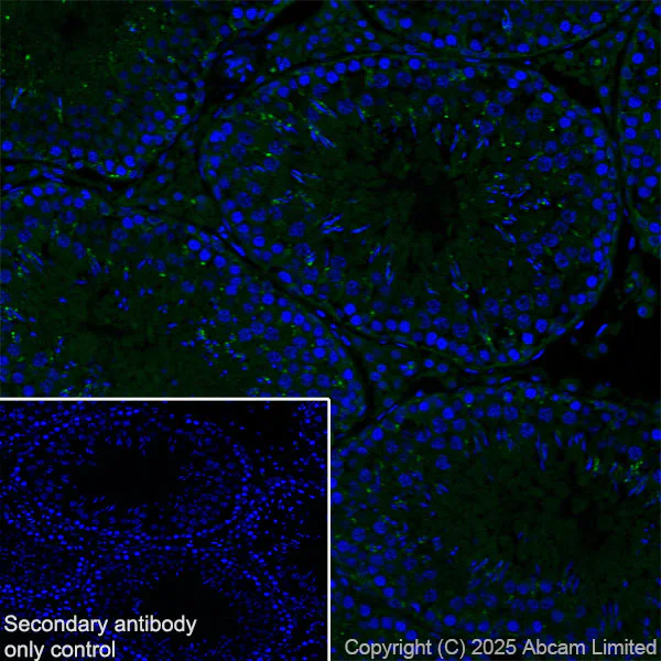 Immunohistochemistry (Frozen sections) - Anti-Snapin antibody [RM2091] (AB324947)