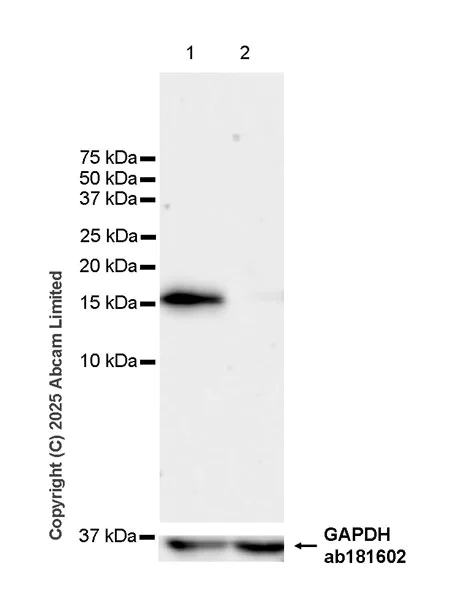 Western blot - Anti-Snapin antibody [RM2091] (AB324947)