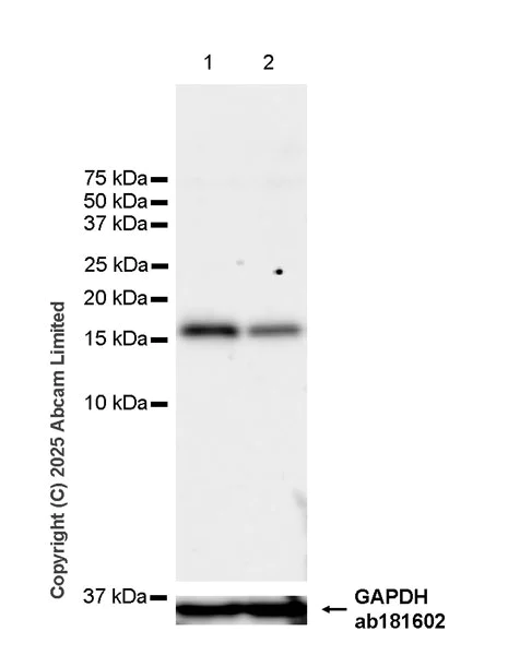 Western blot - Anti-Snapin antibody [RM2091] (AB324947)