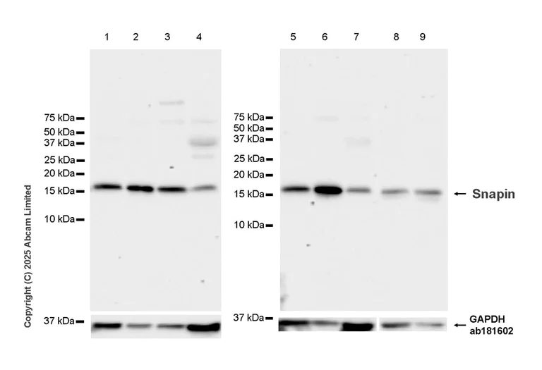Western blot - Anti-Snapin antibody [RM2091] (AB324947)