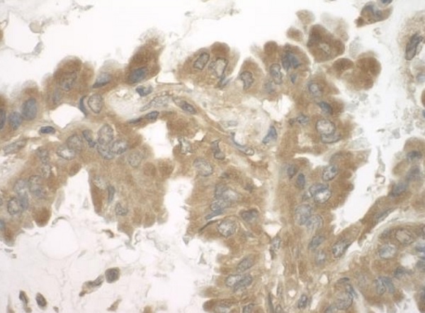 Immunohistochemistry (Formalin/PFA-fixed paraffin-embedded sections) - Anti-SND1 antibody (AB225620), expandable thumbnail