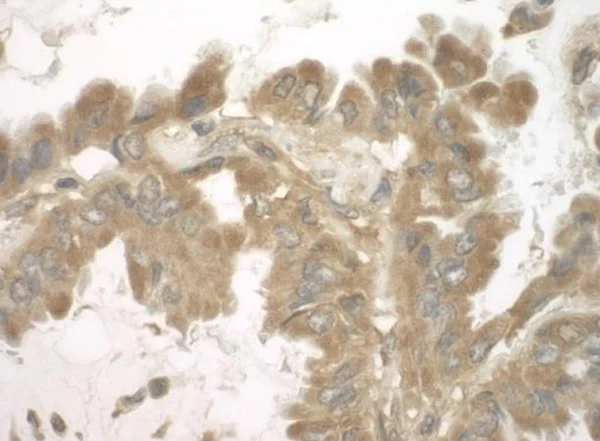 Immunohistochemistry (Formalin/PFA-fixed paraffin-embedded sections) - Anti-SND1 antibody (AB225620)