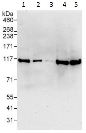 Western blot - Anti-SND1 antibody (AB225620), expandable thumbnail