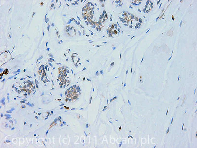 Immunohistochemistry (Formalin/PFA-fixed paraffin-embedded sections) - Anti-SND1 antibody (AB65078)