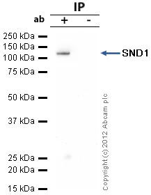 Immunoprecipitation - Anti-SND1 antibody (AB65078)