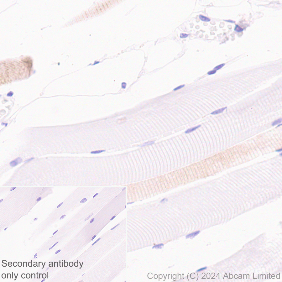 Immunohistochemistry (Formalin/PFA-fixed paraffin-embedded sections) - Anti-SND1 antibody [EPR28903-10] (AB322051), expandable thumbnail