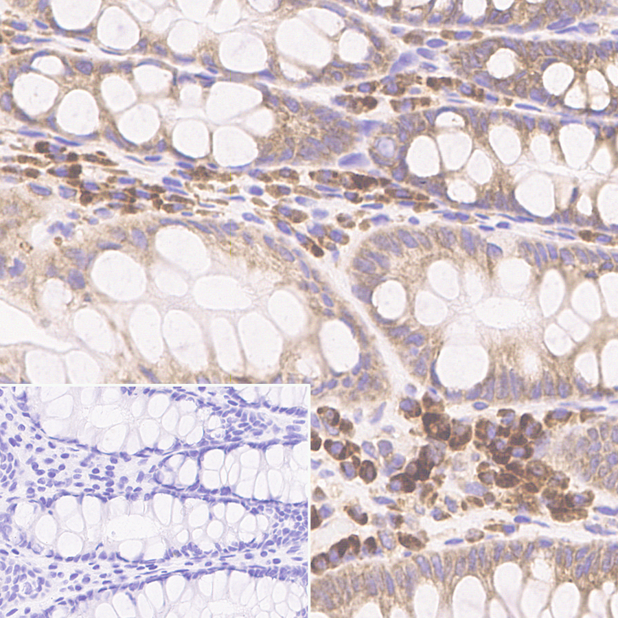 Immunohistochemistry (Formalin/PFA-fixed paraffin-embedded sections) - Anti-SND1 antibody [EPR28903-10] (ab322051), expandable thumbnail
