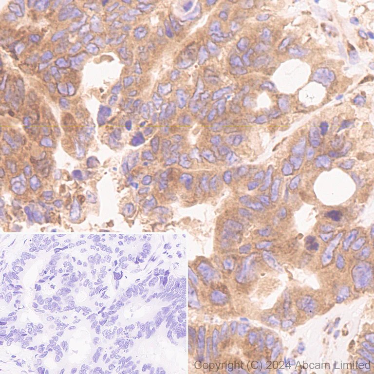 Immunohistochemistry (Formalin/PFA-fixed paraffin-embedded sections) - Anti-SND1 antibody [EPR28903-10] (AB322051)