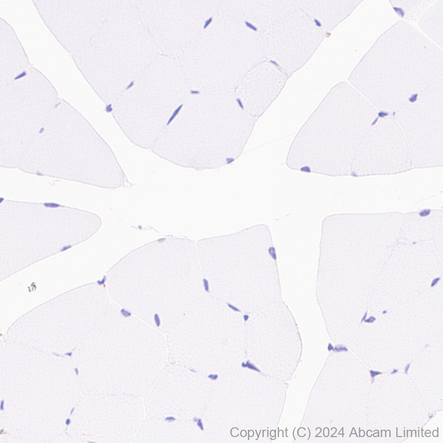 Immunohistochemistry (Formalin/PFA-fixed paraffin-embedded sections) - Anti-SND1 antibody [EPR28903-23] (ab322053), expandable thumbnail
