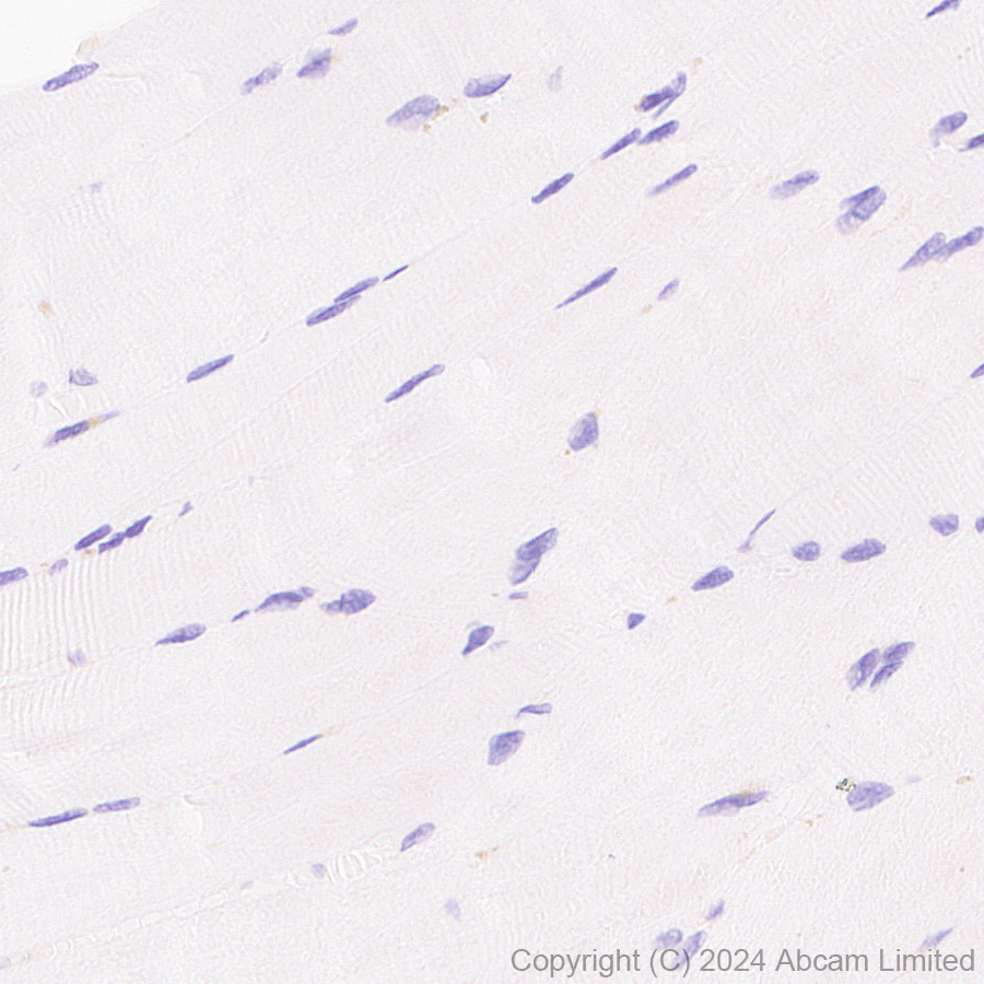 Immunohistochemistry (Formalin/PFA-fixed paraffin-embedded sections) - Anti-SND1 antibody [EPR28903-23] (ab322053), expandable thumbnail