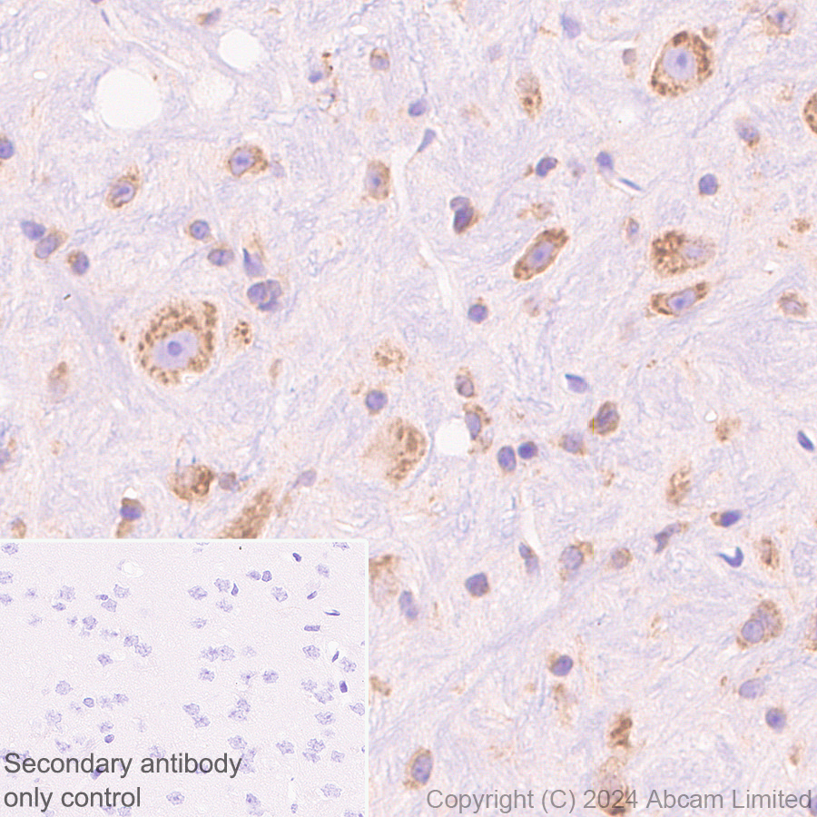 Immunohistochemistry (Formalin/PFA-fixed paraffin-embedded sections) - Anti-SND1 antibody [EPR28903-23] (ab322053), expandable thumbnail