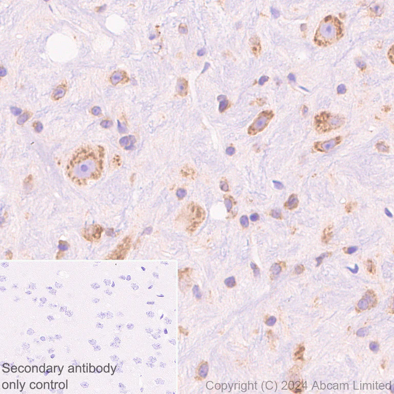 Immunohistochemistry (Formalin/PFA-fixed paraffin-embedded sections) - Anti-SND1 antibody [EPR28903-23] (AB322053)