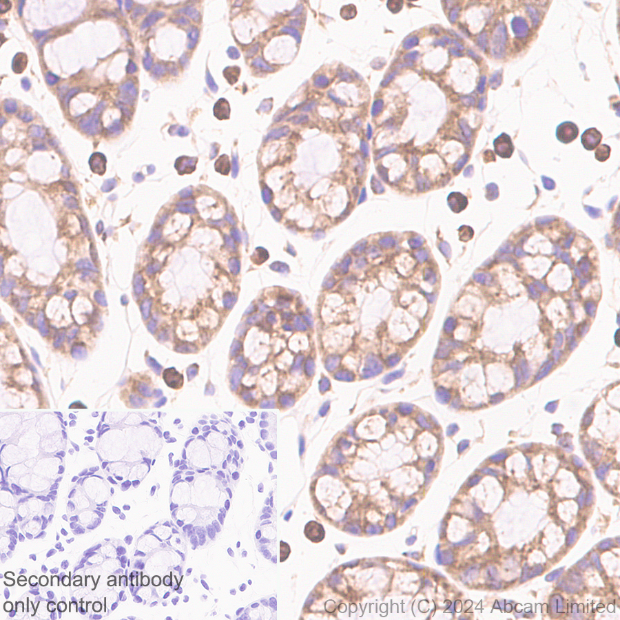 Immunohistochemistry (Formalin/PFA-fixed paraffin-embedded sections) - Anti-SND1 antibody [EPR28903-23] (ab322053), expandable thumbnail