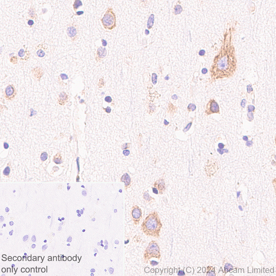 Immunohistochemistry (Formalin/PFA-fixed paraffin-embedded sections) - Anti-SND1 antibody [EPR28903-23] (ab322053), expandable thumbnail