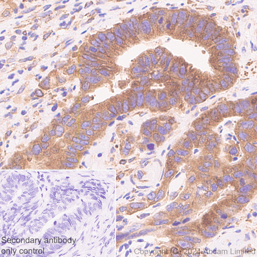 Immunohistochemistry (Formalin/PFA-fixed paraffin-embedded sections) - Anti-SND1 antibody [EPR28903-23] (AB322053), expandable thumbnail