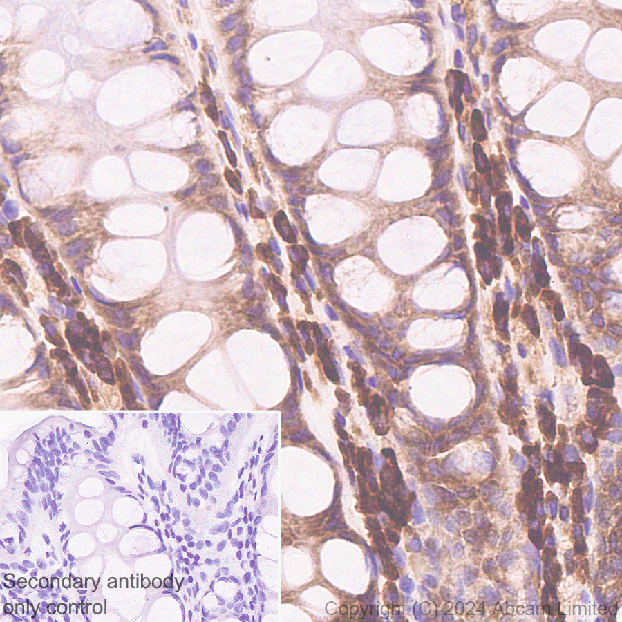 Immunohistochemistry (Formalin/PFA-fixed paraffin-embedded sections) - Anti-SND1 antibody [EPR28903-23] (ab322053), expandable thumbnail