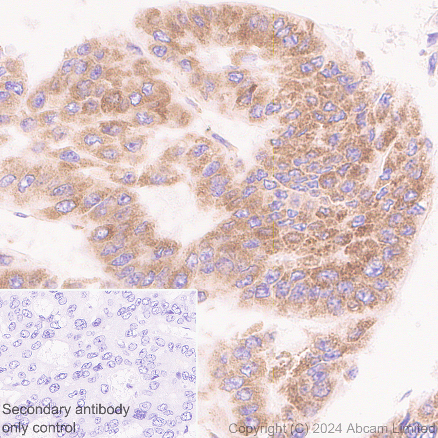 Immunohistochemistry (Formalin/PFA-fixed paraffin-embedded sections) - Anti-SND1 antibody [EPR28903-23] (ab322053), expandable thumbnail
