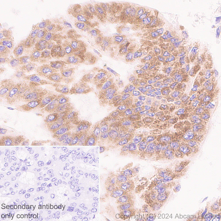 Immunohistochemistry (Formalin/PFA-fixed paraffin-embedded sections) - Anti-SND1 antibody [EPR28903-23] (AB322053)
