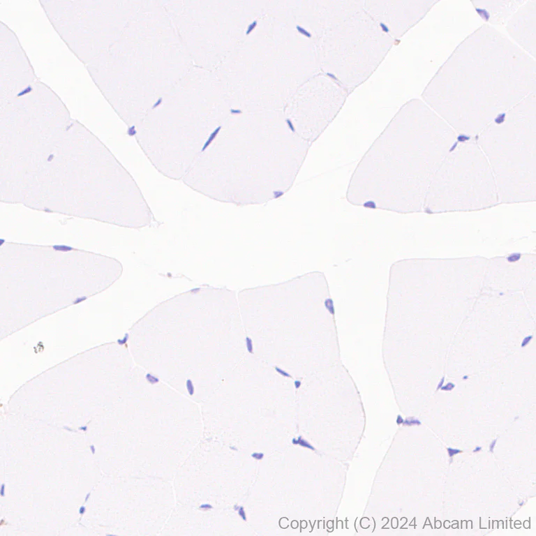 Immunohistochemistry (Formalin/PFA-fixed paraffin-embedded sections) - Anti-SND1 antibody [EPR28903-23] - BSA and Azide free (AB322054)