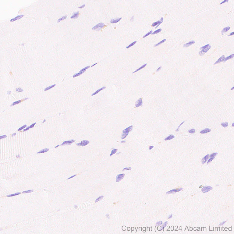 Immunohistochemistry (Formalin/PFA-fixed paraffin-embedded sections) - Anti-SND1 antibody [EPR28903-23] - BSA and Azide free (AB322054)