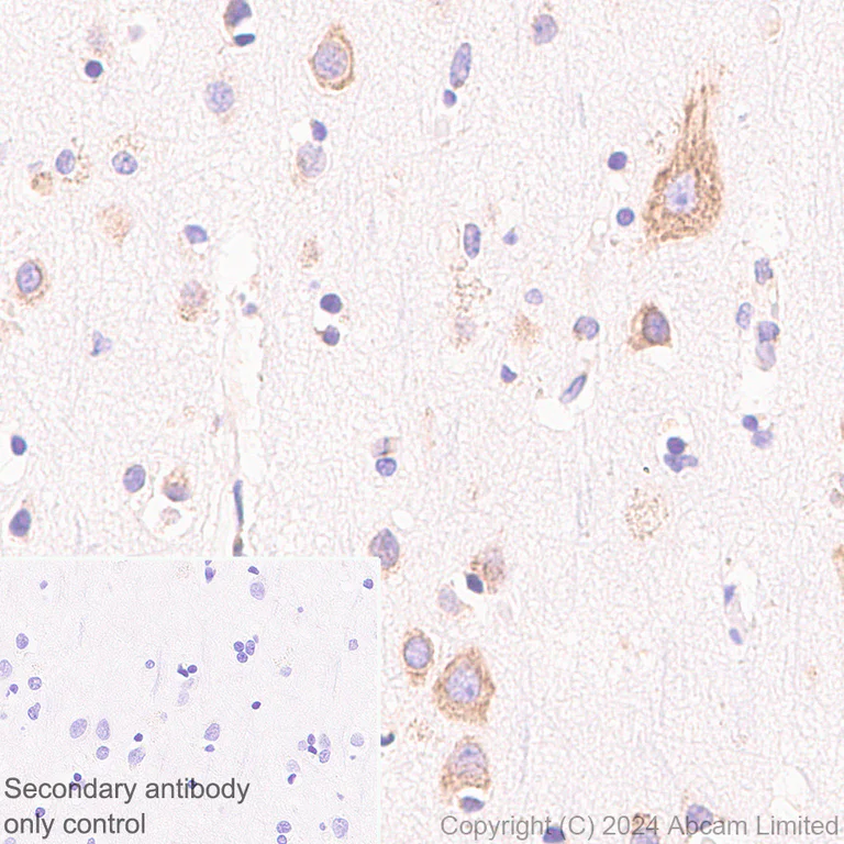 Immunohistochemistry (Formalin/PFA-fixed paraffin-embedded sections) - Anti-SND1 antibody [EPR28903-23] - BSA and Azide free (AB322054)