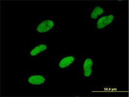 Immunocytochemistry/ Immunofluorescence - Anti-SNF2H antibody (AB168653)